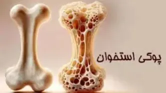وقتی استخوان‌ها پوک می‌شوند