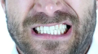 چرا دندان‌ها زرد می‌شوند؟ این عادت‌ها را بشناسید