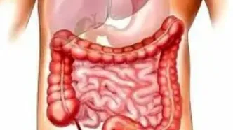 بهترین گیاه دارویی برای سلامت روده