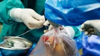 ماجرای فروش اعضای بدن در ایران + فیلم