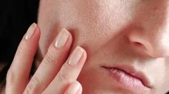 این میوه پوست شما را جوان نگه می‌دارد