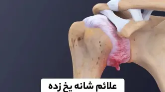 اهمیت بررسی ابتلا به بیماری های زمینه ای در سندروم شانه یخ زده