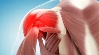 سندروم شانه یخ زده را حتما بررسی کنید!