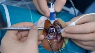 نخستین جراحی تخصصی شبکیه چشم در خرمشهر