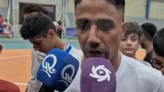 بازگشت درخشان فوق ستاره به میادین با صورت زخمی