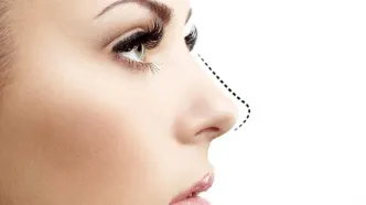 بهترین جراحی بینی در ایلام؛ انتخابی مهم برای زیبایی بیشتر