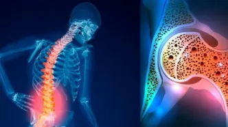 این بیماری از دهه چهارم زندگی شروع می‌شود