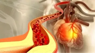 ادویه‌ای که کلسترول خون را کاهش می‌دهد