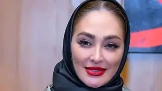 تصاویر باورنکردنی از چهره عملی الهام حمیدی