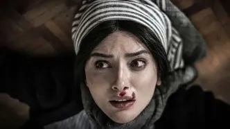 استوری عجیب بازیگر سریال شغال+عکس