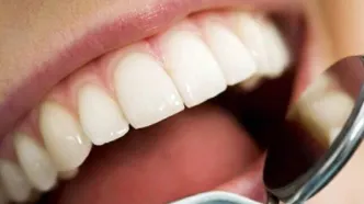 ارتباط رنگ دندان‌ با بیماری های مختلف