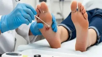 کاهش خطر قطع عضو بیماران دیابتی با الگوریتم‌های هوش مصنوعی