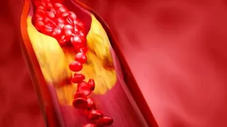مهم‌ترین راهکار کنترل چربی خون برای افراد بالای ۳۰ سال