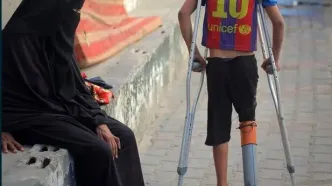 تصاویر؛ لوله پلاستیکی جای پای قطع شده کودک فلسطینی را گرفت