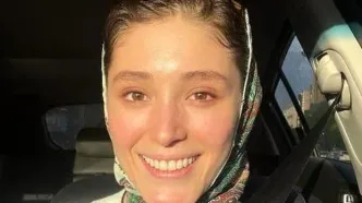 عکس فرشته حسینی با چشم کبود که حسابی وایرال شد!