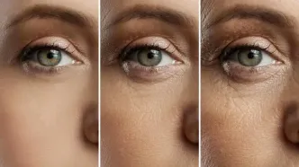 کشف راهکاری نوین برای درمان پیرچشمی