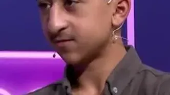تغییرچهره جالب امیرعباسِ کچلیک در نوجوانی