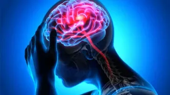 زمان طلایی برای نجات بیماران سکته مغزی