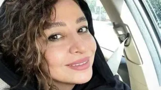 چهره جدید مهلقا باقری: تغییرات جنجالی پس از عمل زیبایی!