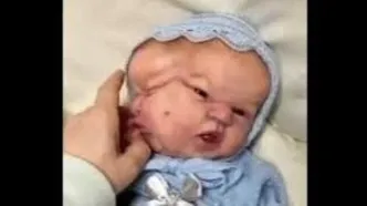 تولد نوزاد عجیب الخلقه هندی با 3 صورت و 3 چشم / ویدئو
