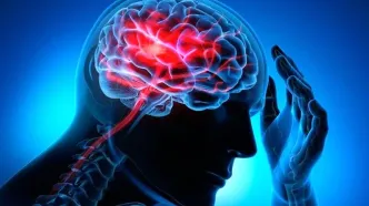 سن سکته مغزی در ایران ۱۰ سال کمتر از دنیاست!