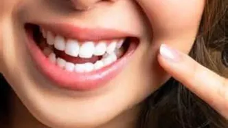 خوراکی‌های مفید برای سلامت دندان