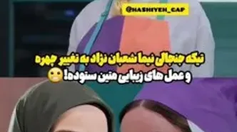 عمل‌های زیبایی متین ستوده سوژه نیما شعبان‌نژاد شد + فیلم