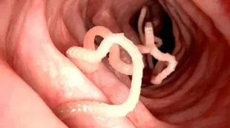 این علائم ساده در کودک تان یعنی به بیماری انگلی مبتلا شده!