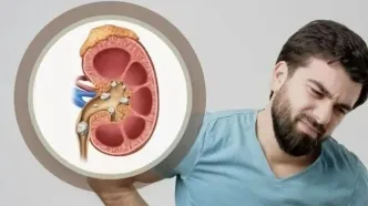 درد سنگ کلیه شما را کلافه کرده است این نوشیدنی ها مختص شماست