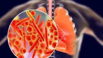 بیماری انسدادی مزمن ریه چهارمین علت مرگ‌ و میر جهان است