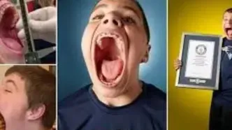 ایزاک جانسون؛ مردی با بزرگ‌ترین دهان دنیا/ ویدئو