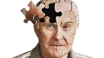 پیشگیری از آلزایمر امکان‌پذیر است