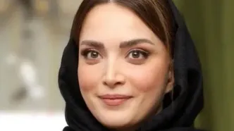 ویدئوی زیرخاکی از بهنوش طباطبایی | تغییر شگفت‌انگیز خانم بازیگر بعد از عمل زیبایی