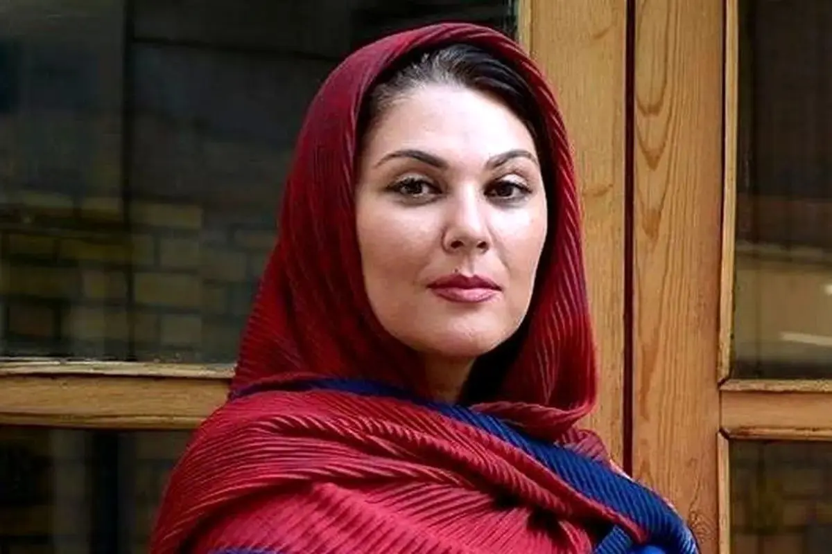 تغییر چهره لاله اسکندری بعد از عمل زیبایی/ ویدئو