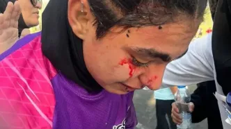 تمام حواشی هفته هشتم لیگ زنان؛ خون و خونریزی در تهران!