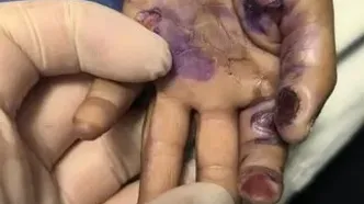 فوت دردناک یک کودک 4ساله در پی آزار و اذیت