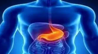 این داروها دومین علت شایع زخم معده هستند