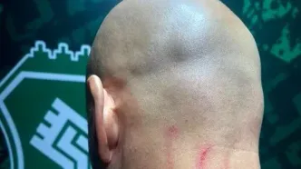 تصویری از جراحت مربی دروازه بانان استقلال بعد از بازی با خیبر