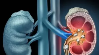 با مصرف این ۶ میوه‌ کلیه های شما فول انرژی می شود
