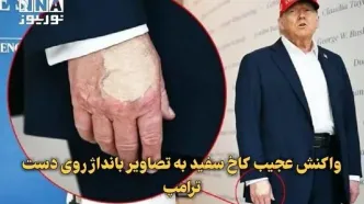 واکنش کاخ سفید به تصاویر بانداژ روی دست ترامپ + ببینید