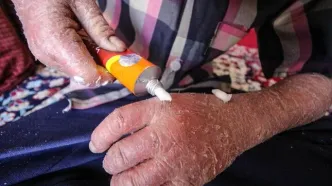 ماجرای رها شدن یک نوزاد پروانه‌ای در بیمارستان