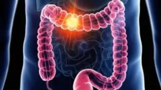 از کنار این علائم گوارشی به سادگی عبور نکنید