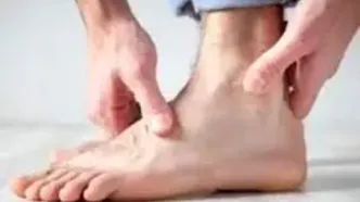 بی حسی ساق پا تا چه حد میتواند خطرناک باشد؟