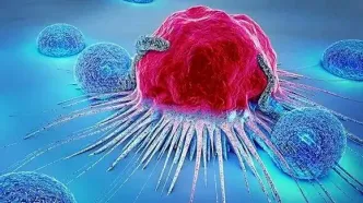 در ایران بین ۳۰ تا ۴۰ دقیقه، یک زن به سرطان سینه مبتلا می‌شود/ هر سال ۲۰ هزار بیمار جدید داریم