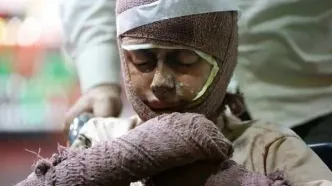 قیمت لباس سوختگی ۲ تا ۴۰ میلیون تومان