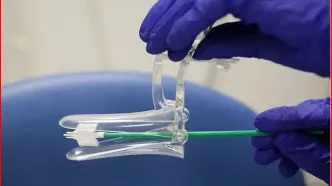 چه زمانی تست پاپ اسمیر انجام دهیم؟+ اینفوگرافی