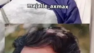 وضعیت تلخ حمید طالقانی پس از ابتلا به سرطان روی تخت بیمارستان