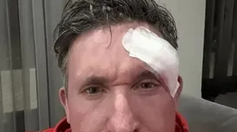 اسطوره لیورپول درگیر سرطان شد