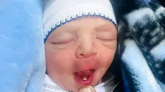 این نوزاد با چیزی غیرعادی به دنیا آمد!