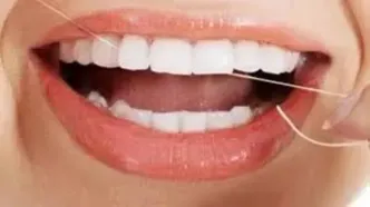 آیا  نخ دندان  در سلامت دندانها تاثیری دارد؟